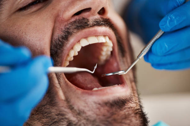 Best Broken or Chipped Tooth Repair in Cocoa West, FL